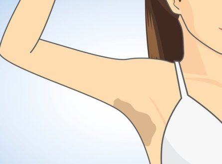 Natural remedies for dark underarms