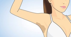 Natural remedies for dark underarms