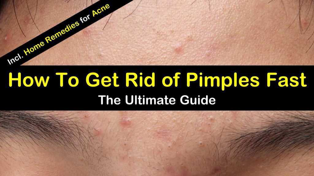 Home Remedies To Get Rid Of Pimples