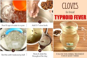 Home Remedies for Typhoid Fever